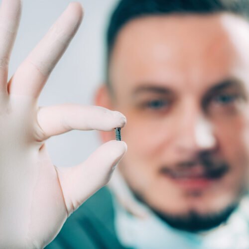 Dentist holding dental implat